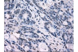 Image no. 8 for anti-Interferon Regulatory Factor 3 (IRF3) antibody (ABIN1498899) (IRF3 Antikörper)