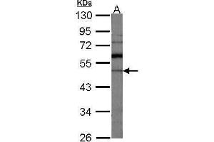 WB Image Sample (30 ug of whole cell lysate) A:NIH-3T3 10% SDS PAGE antibody diluted at 1:1000 (GDI1 Antikörper)