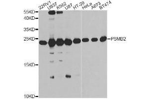 Western blot analysis of extracts of various cell lines, using PSMB2 antibody. (PSMB2 Antikörper  (AA 1-201))