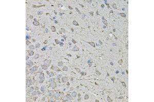 Immunohistochemistry of paraffin-embedded mouse brain using CDK10 antibody. (CDK10 Antikörper)