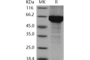 Western Blotting (WB) image for Heat Shock 70kDa Protein 1A (HSPA1A) (Active) protein (His tag) (ABIN7317034) (HSP70 1A Protein (His tag))