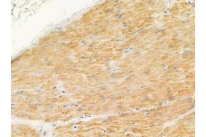 ABIN6259436 and ABIN6276266 at 1/100 staining human normal gastric tissue by IHC-P.