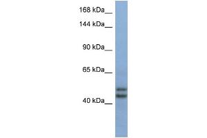 Host:  Rabbit  Target Name:  TEX10  Sample Type:  Fetal Brain lysates  Antibody Dilution:  1. (TEX10 Antikörper  (Middle Region))