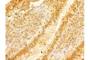ABIN7094226 and ABIN7098273 at 1/100 staining Rat colon tissue by IHC-P. (FBXO7 Antikörper  (C-Term))