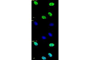 Histone H4ac (pan-acetyl) antibody (pAb) tested by immunofluorescence.