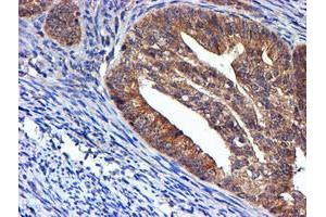 Image no. 11 for anti-NADH Dehydrogenase (Ubiquinone) Complex I, Assembly Factor 7 (NDUFAF7) antibody (ABIN1499667) (NDUFAF7 Antikörper)