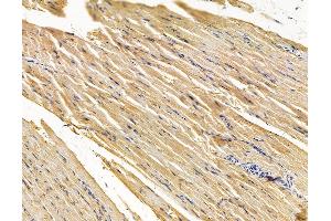 ABIN7095941 and ABIN7100003 at 1/100 staining rat muscle tissue by IHC-P. (FBLN2 Antikörper)