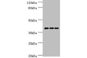 Western blot All lanes: Paired box protein Pax-4 antibody at 6 μg/mL Lane 1: Hela whole cell lysate Lane 2: K562 whole cell lysate Lane 3: Mouse pancreatic Secondary Goat polyclonal to rabbit IgG at 1/10000 dilution Predicted band size: 38, 30 kDa Observed band size: 38 kDa (PAX4 Antikörper  (AA 50-200))