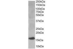 Image no. 1 for anti-Ubiquitin-Conjugating Enzyme E2I (UBE2I) (N-Term) antibody (ABIN374291) (UBE2I Antikörper  (N-Term))