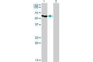 Western Blot analysis of SLC33A1 expression in transfected 293T cell line by SLC33A1 monoclonal antibody (M07), clone 3A4. (SLC33A1 Antikörper  (AA 1-69))