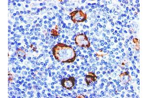 Immunohistochemistry (IHC) image for anti-Fucosyltransferase 4 (Alpha (1,3) Fucosyltransferase, Myeloid-Specific) (FUT4) antibody (ABIN6939471)