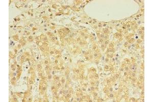 Immunohistochemistry of paraffin-embedded human adrenal gland tissue using ABIN7149631 at dilution of 1:100 (DHRSX Antikörper  (AA 32-330))