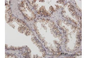 Immunostaining (ISt) image for anti-Arginase, Type II (ARG2) (AA 1-354) antibody (ABIN513470)