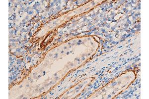 ABIN6267068 at 1/100 staining human seminoma tissue sections by IHC-P. (Smooth Muscle Actin Antikörper  (N-Term))