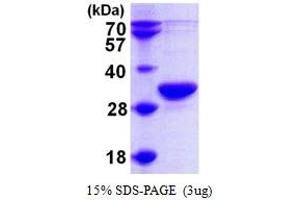 SDS-PAGE (SDS) image for Ribonuclease P/MRP 30kDa Subunit (RPP30) (AA 1-268) protein (His tag) (ABIN667291) (RPP30 Protein (AA 1-268) (His tag))