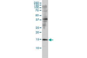 GMFB monoclonal antibody (M01), clone 2G12-2A2 Western Blot analysis of GMFB expression in Jurkat . (GMFB Antikörper  (AA 1-154))