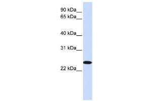 Western Blotting (WB) image for anti-Zinc Finger, DHHC-Type Containing 19 (ZDHHC19) antibody (ABIN2458905) (ZDHHC19 Antikörper)