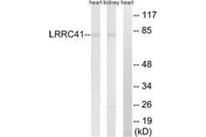 Western blot analysis of extracts from rat kidney/rat heart cells, using LRRC41 Antibody.