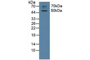 Detection of CHRM1 in Rat Brain Tissue using Polyclonal Antibody to Cholinergic Receptor, Muscarinic 1 (CHRM1) (CHRM1 Antikörper  (AA 210-363))