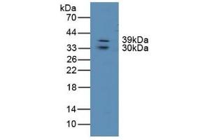 Detection of LIPG in Human Lung Tissue using Polyclonal Antibody to Lipase, Endothelial (LIPG) (LIPG Antikörper  (AA 175-412))