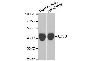 Western blot analysis of extracts of mouse kidney and rat kidney cell lines, using GATM antibody.