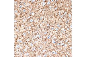 Immunohistochemistry of paraffin-embedded mouse brain using V Rabbit mAb (ABIN7271312) at dilution of 1:100 (40x lens). (VAMP1 Antikörper)
