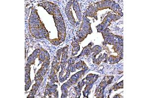 IHC analysis of Syntaxin 18/STX18 using anti-Syntaxin 18/STX18 antibody (ABIN7599259). (Syntaxin 18 Antikörper  (AA 1-313))