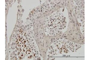 Image no. 1 for anti-Transition Protein 1 (During Histone To Protamine Replacement) (TNP1) (AA 1-56) antibody (ABIN598980) (TNP1 Antikörper  (AA 1-56))