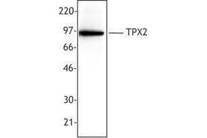 Western Blotting (WB) image for anti-TPX2, Microtubule-Associated, Homolog (Xenopus Laevis) (TPX2) antibody (ABIN2665435) (TPX2 Antikörper)