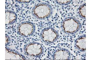 Immunohistochemical staining of paraffin-embedded Human colon tissue using anti-NDEL1 mouse monoclonal antibody. (NDEL1 Antikörper)