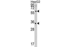 Western Blotting (WB) image for anti-CDP-Diacylglycerol Synthase (Phosphatidate Cytidylyltransferase) 2 (CDS2) antibody (ABIN5018827) (CDS2 Antikörper)
