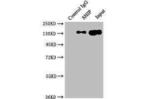 Immunoprecipitating SHIP in Raji whole cell lysate Lane 1: Rabbit control IgG instead of ABIN7127806 in Raji whole cell lysate. (Rekombinanter INPP5D Antikörper)