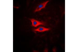 Immunofluorescent analysis of PLA2G4A (pS505) staining in HeLa cells. (PLA2G4A Antikörper  (pSer505))