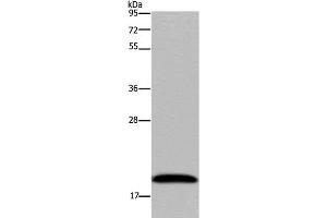 Western Blot analysis of 293T cell using NDUFA8 Polyclonal Antibody at dilution of 1:300 (NDUFA8 Antikörper)
