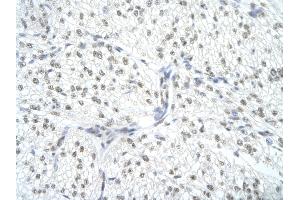 Rabbit Anti-SNRPA Antibody       Paraffin Embedded Tissue:  Human cardiac cell   Cellular Data:  Epithelial cells of renal tubule  Antibody Concentration:   4. (SNRPA1 Antikörper  (Middle Region))