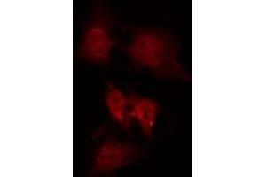 ABIN6266971 staining Hela by IF/ICC. (GPRASP1 Antikörper  (Internal Region))