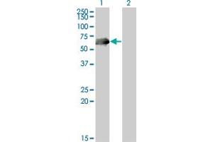 Western Blot analysis of CDC25C expression in transfected 293T cell line by CDC25C monoclonal antibody (M01A), clone 3B11. (CDC25C Antikörper  (AA 21-130))