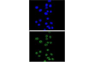 Confocal immunofluorescent analysis of NBN Antibody (C-term) (ABIN655721 and ABIN2845169) with Hela cell followed by Alexa Fluor® 488-conjugated goat anti-rabbit lgG (green). (Nibrin Antikörper  (C-Term))