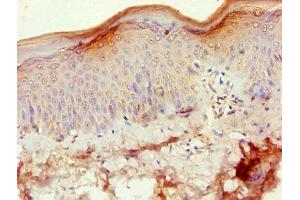 Immunohistochemistry of paraffin-embedded human skin tissue using ABIN7170845 at dilution of 1:100 (MMP3 Antikörper  (AA 100-477))