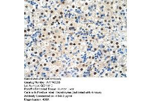 Human Liver (ZNF326 Antikörper  (C-Term))