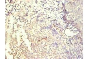 Immunohistochemical of paraffin-embedded human tonsil tissue using ABIN7156932 at dilution of 1:200. (IL-8 Antikörper)