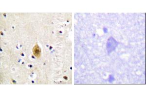 Immunohistochemistry analysis of paraffin-embedded human brain tissue, using Mst1/2 (Phospho-Thr183) antibody. (MST1/MST2 (pThr183) Antikörper)