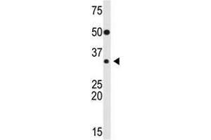 Image no. 1 for anti-Snail Family Zinc Finger 2 (SNAI2) (Middle Region) antibody (ABIN2853627) (SLUG Antikörper  (Middle Region))