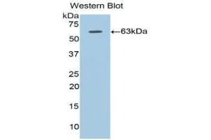 Western blot analysis of the recombinant protein. (Adiponectin Receptor 1 Antikörper  (AA 1-136))