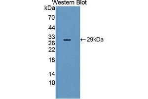 Western blot analysis of the recombinant protein. (HAND1 Antikörper  (AA 1-215))
