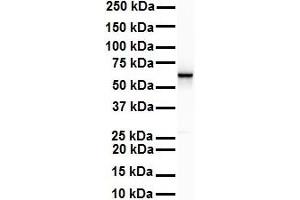 WB Suggested Anti-SNRP70 antibody Titration: 1 ug/mL Sample Type: Human Raji (SNRNP70 Antikörper  (C-Term))