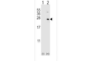 Western blot analysis of HPRT1 (arrow) using rabbit polyclonal HPRT1 Antibody (C-term) (ABIN390692 and ABIN2840982). (HPRT1 Antikörper  (C-Term))