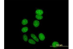 Immunofluorescence of purified MaxPab antibody to ZNF354A on MCF-7 cell. (ZNF354A Antikörper  (AA 1-605))