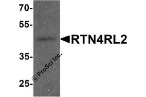 Western Blotting (WB) image for anti-Reticulon 4 Receptor-Like 2 (RTN4RL2) (C-Term) antibody (ABIN1077412) (RTN4RL2 Antikörper  (C-Term))