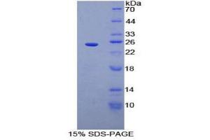 SDS-PAGE (SDS) image for Sprouty Homolog 2 (SPRY2) (AA 116-304) protein (His tag) (ABIN1878986)